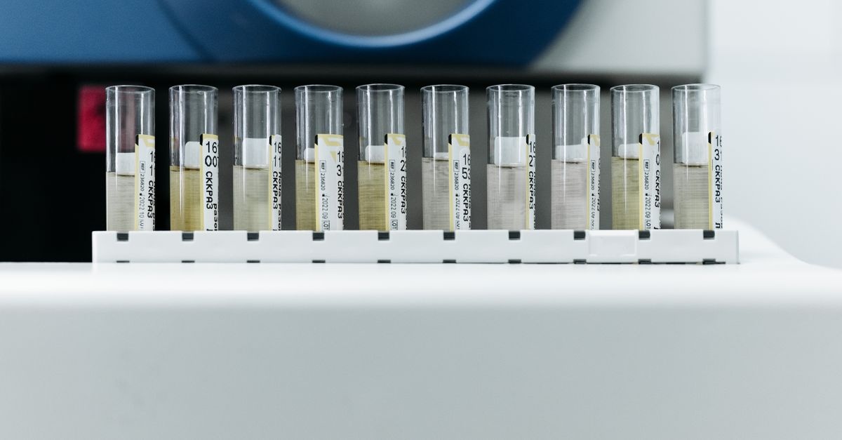 Testy nietolerancji pod lupą: jak odróżnić rzetelną diagnostykę od marketingu?