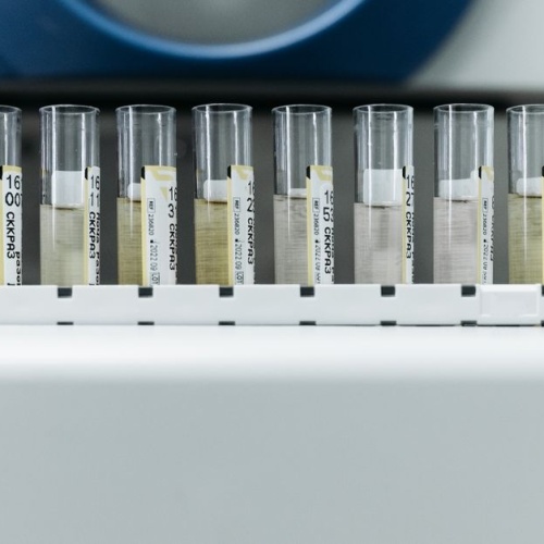Testy nietolerancji pod lupą: jak odróżnić rzetelną diagnostykę od marketingu?